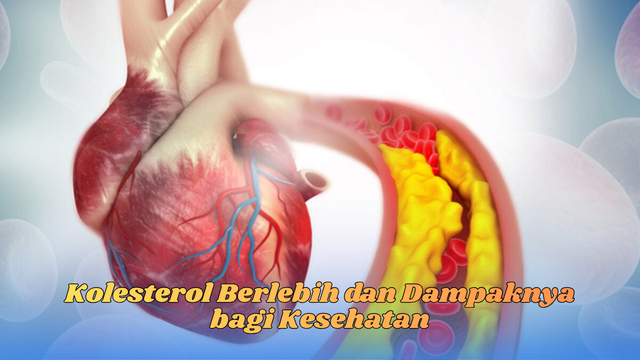 kolesterol berlebih